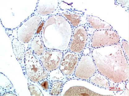 TTR Monoclonal Antibody (2B12)