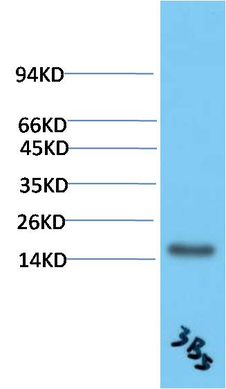 TTR Monoclonal Antibody (3B5)