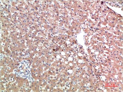 TTR Monoclonal Antibody (3B5)