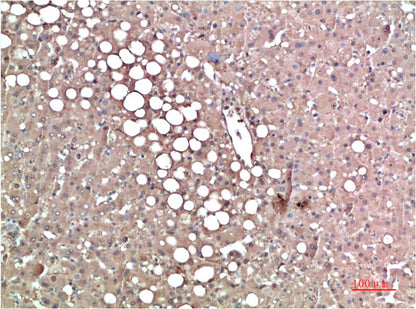 TTR Monoclonal Antibody (3G7)