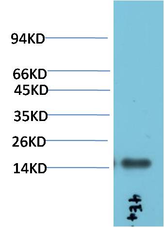 TTR Monoclonal Antibody (4E4)