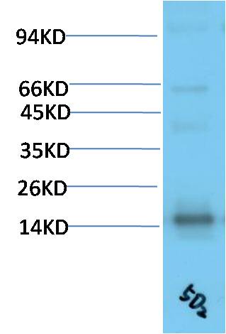 TTR Monoclonal Antibody (5D2)