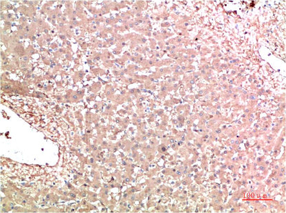 TTR Monoclonal Antibody (5D2)