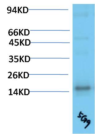 TTR Monoclonal Antibody (5G9)