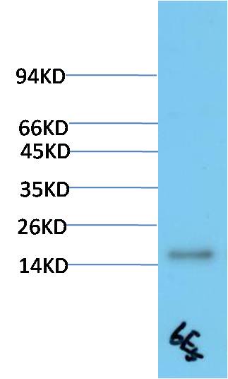 TTR Monoclonal Antibody (6E5)