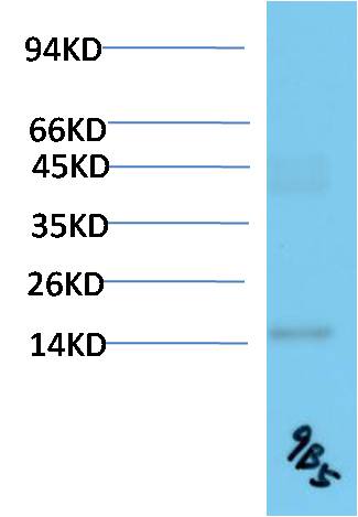 TTR Monoclonal Antibody (9B5)