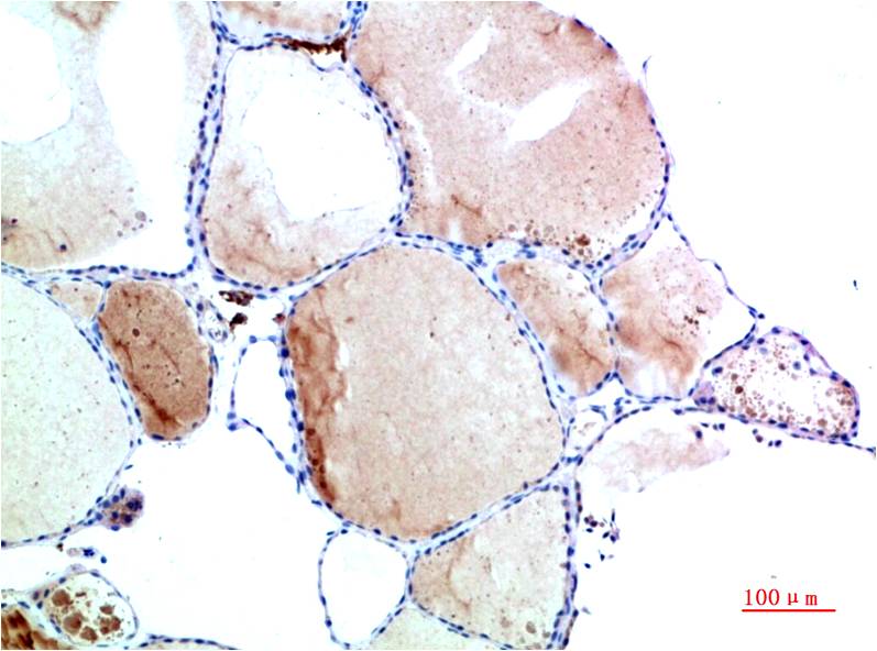 TTR Monoclonal Antibody (9B5)