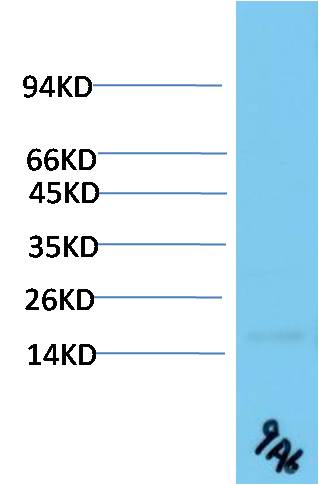 TTR Monoclonal Antibody (9A6)