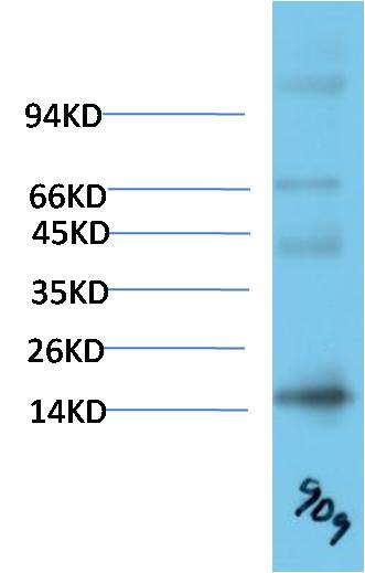 TTR Monoclonal Antibody (9D9)