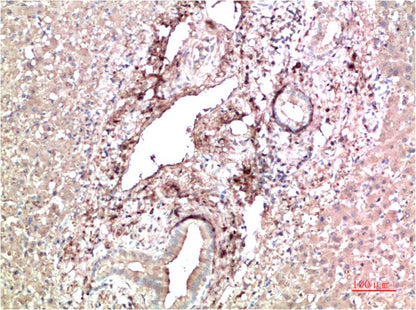 TTR Monoclonal Antibody (9D9)