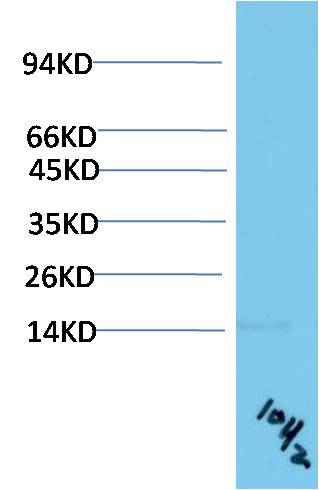 TTR Monoclonal Antibody (10H2)