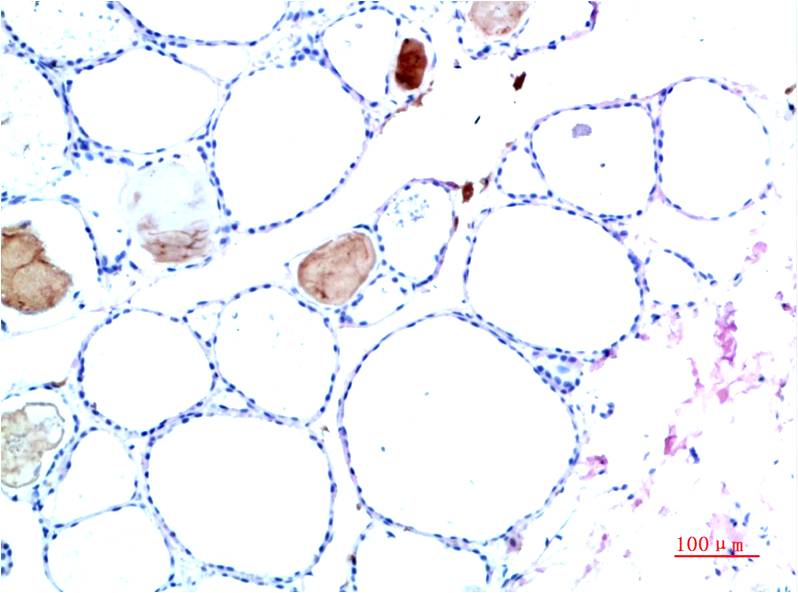 TTR Monoclonal Antibody (10H2)