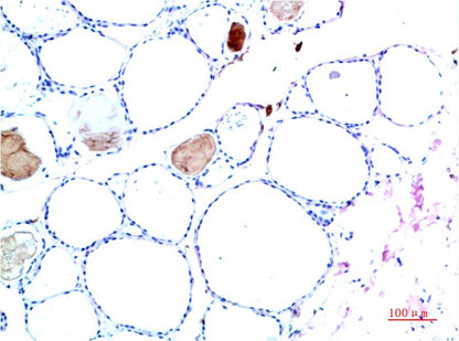 TTR Monoclonal Antibody (10H2)