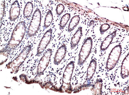 HP-1 Gamma Monoclonal Antibody (2F5）