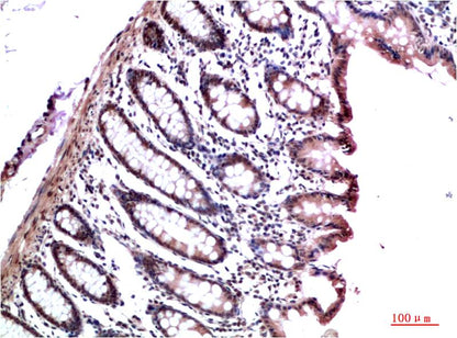 HP-1 Gamma Monoclonal Antibody (3B9）