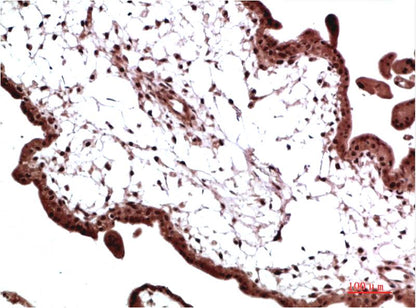 HP-1 Gamma Monoclonal Antibody (4F4）