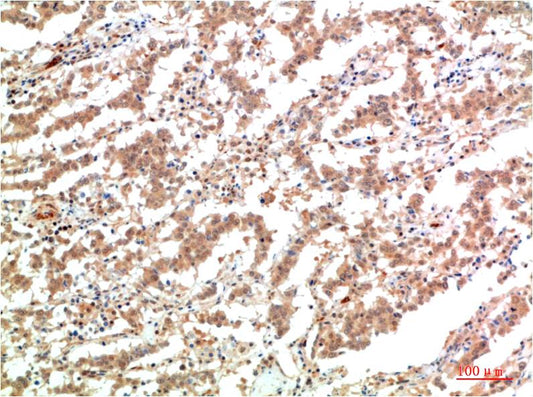 JAK2 Monoclonal Antibody (3F10)