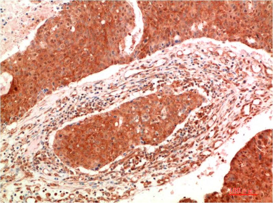 JAK2 Monoclonal Antibody (9B4)