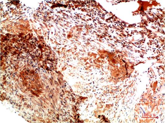 Collagen II Monoclonal Antibody (1H1)