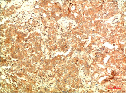 ATG5 Monoclonal Antibody (3C7)