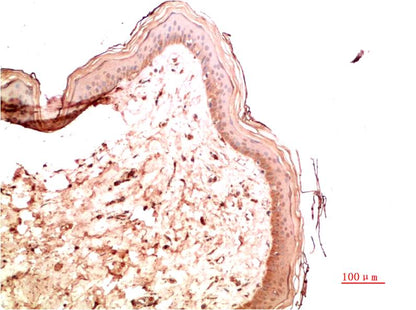 Collagen IV Monoclonal Antibody (5E10)