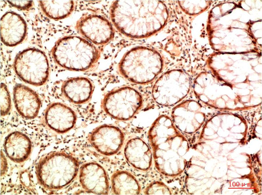 Acetyl P53 (K382) Monoclonal Antibody (5H10)