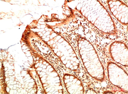 Acetyl P53 (K382) Monoclonal Antibody (5H10)