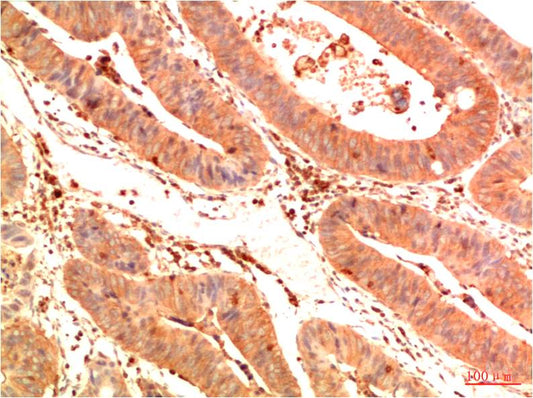 Acetyl P53 (K382) Monoclonal Antibody (1G7)
