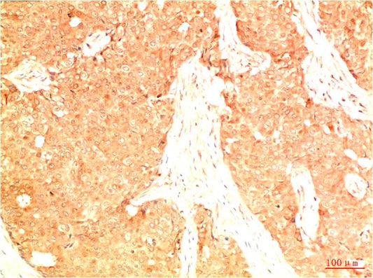 Acetyl P53 (K382) Monoclonal Antibody (15F4)