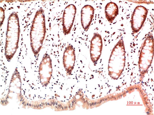 Collagen I Monoclonal Antibody (4H10)