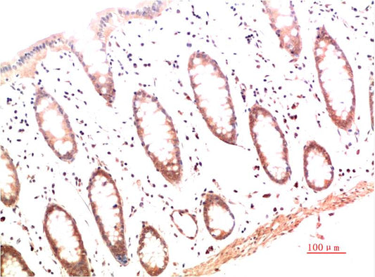 Collagen I Monoclonal Antibody (4B5)
