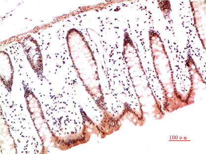 Collagen I Monoclonal Antibody (2D10)