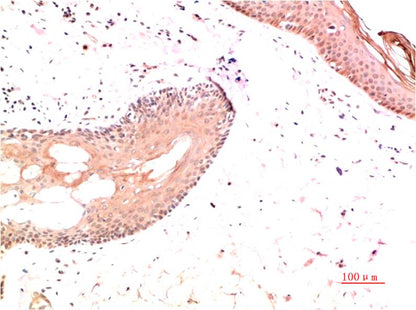 Collagen I Monoclonal Antibody (2D10)