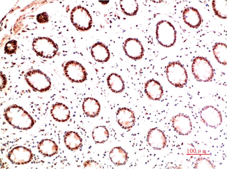 Collagen I Monoclonal Antibody (5B7)