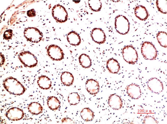 Collagen I Monoclonal Antibody (5B7)