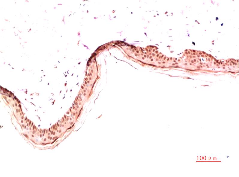 Collagen I Monoclonal Antibody (5B7)