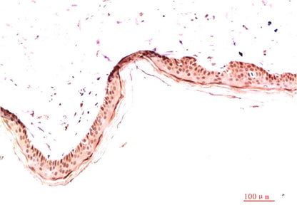 Collagen I Monoclonal Antibody (5B7)
