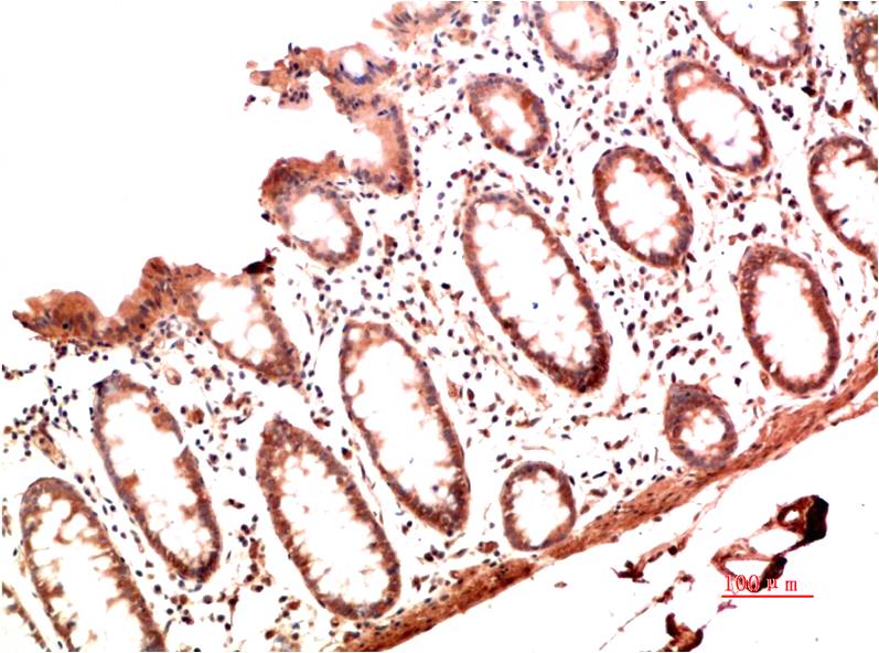 Collagen I Monoclonal Antibody (1B2)
