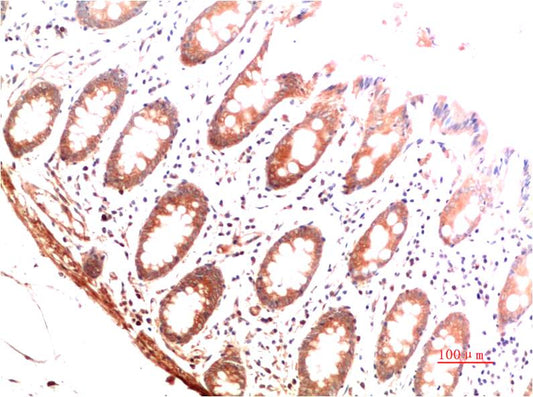 Collagen I Monoclonal Antibody (6E11)