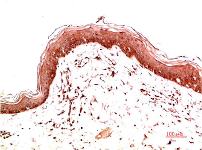 Collagen I Monoclonal Antibody (6E11)
