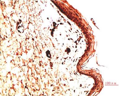 Collagen IV Monoclonal Antibody (5C9)