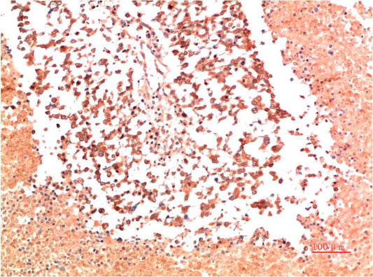 Collagen II Monoclonal Antibody (9C5)
