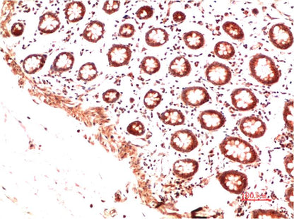 Collagen II Monoclonal Antibody (9C5)