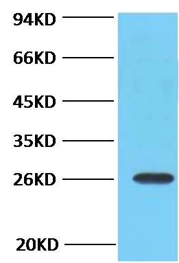 Bcl-2 Monoclonal Antibody (6B5）