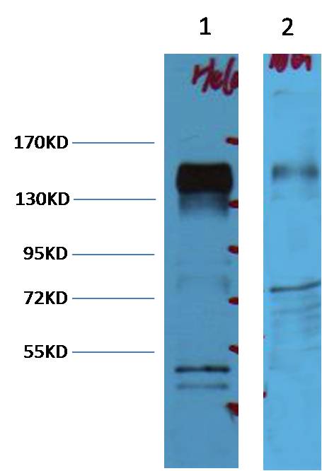 ErbB2-HER-2 Monoclonal Antibody (11H9)