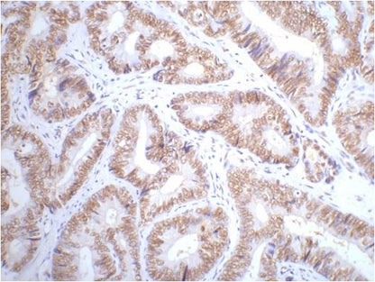 p53 Monoclonal Antibody (6C4)