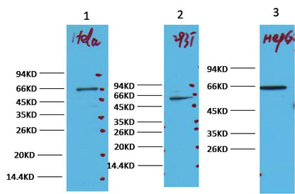 NFkB p65 Monoclonal Antibody (14H2)