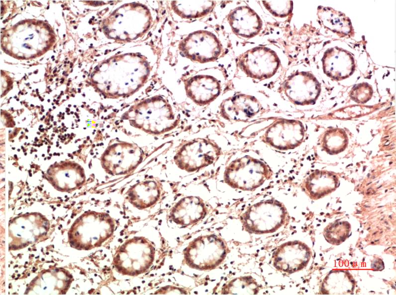 Collagen II Monoclonal Antibody (7F9)