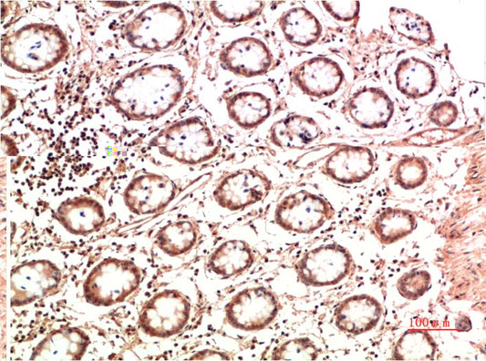 Collagen II Monoclonal Antibody (7F9)