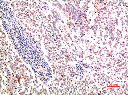 Collagen II Monoclonal Antibody (7F9)